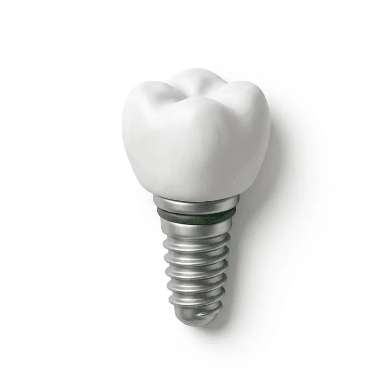 Dental Implants